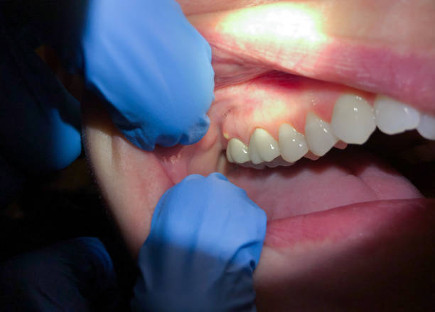 Best After-Hours Dental Trauma Care in Vance, AL